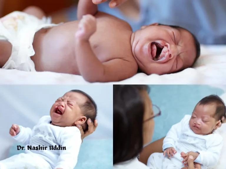 Cleft lip repair