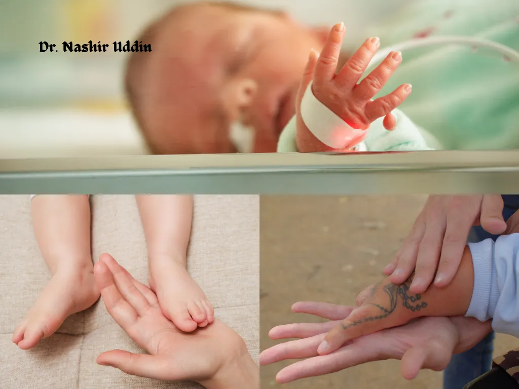 Correction of Congenital Hand Problems