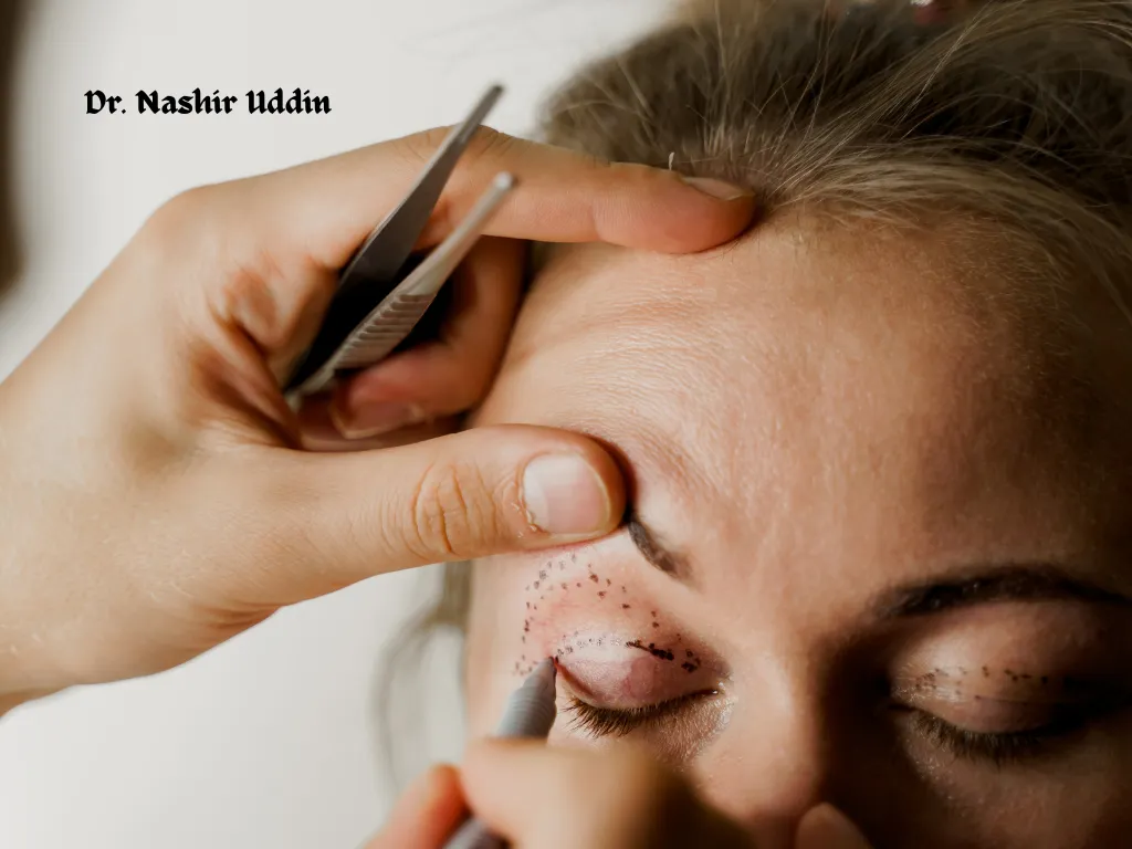 Eyelid surgery Blepharoplasty
