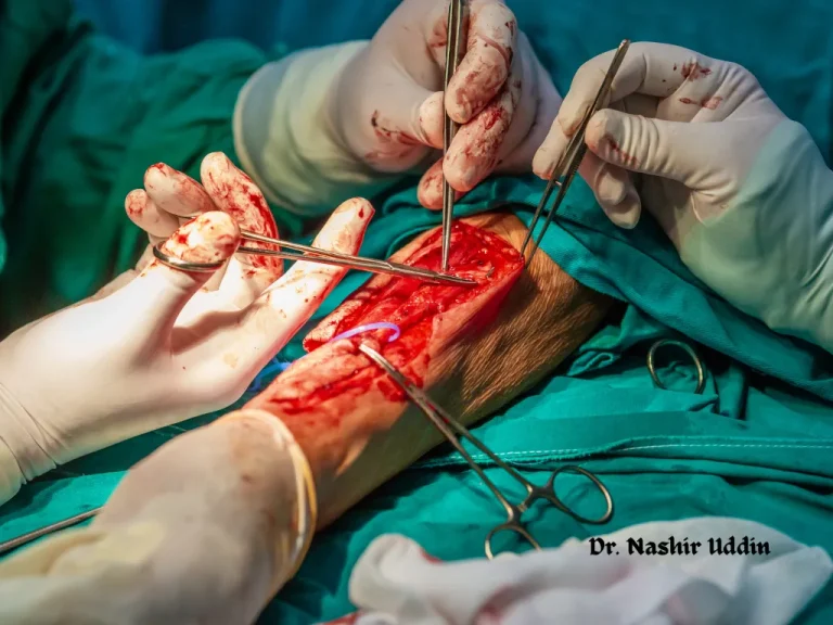 Flap surgery (moving skin, muscle, or tissue to cover defects)