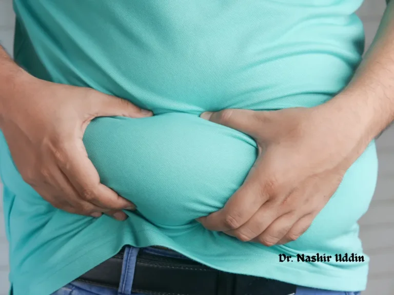 Liposuction removing excess fat