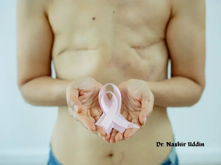 Reconstruction after cancer surgery